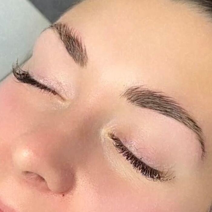 Réhaussement de Sourcils - BROWLIFT